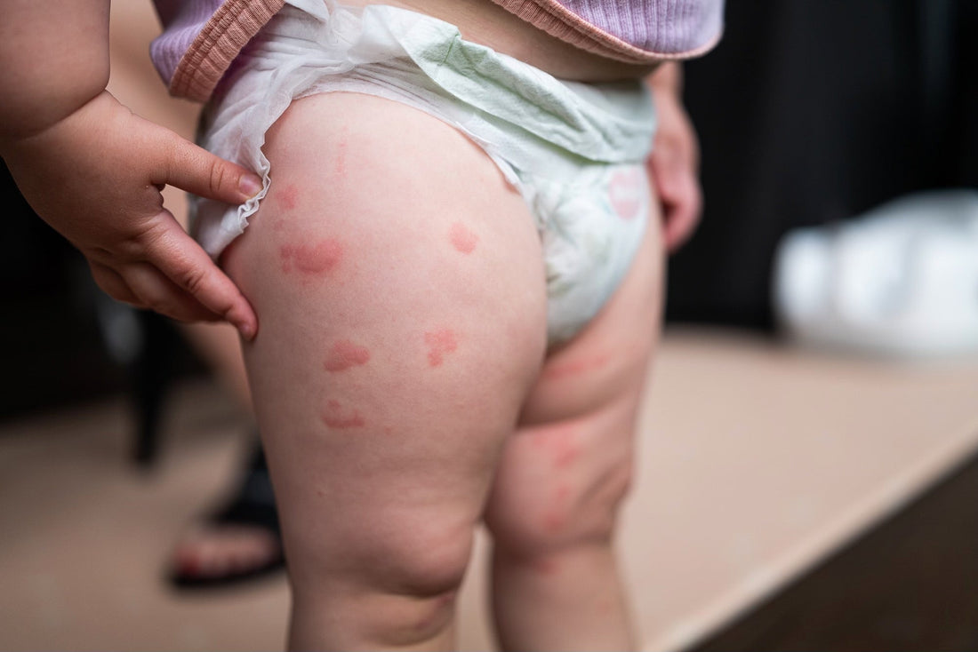 Lets talk allergies